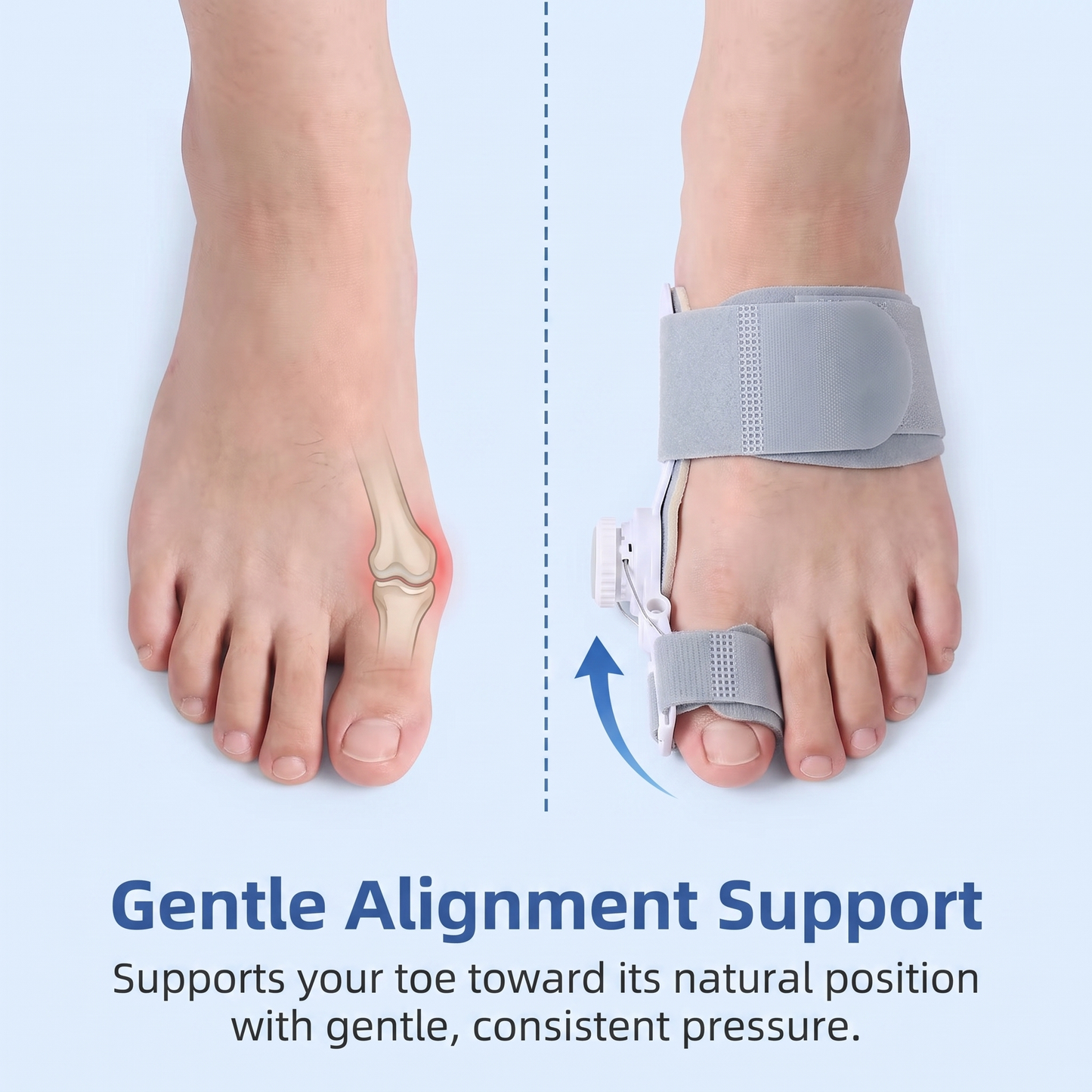 PureClinicalCare Bunion Corrector Brace